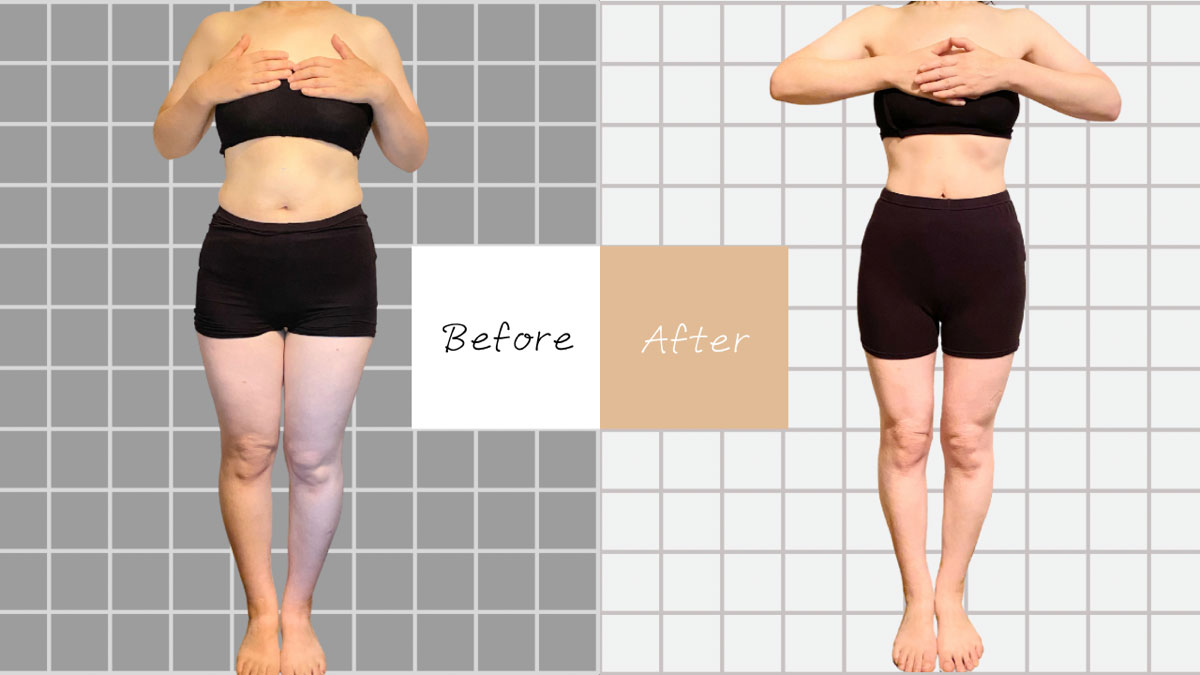 痩身 ダイエット専門サロン ユアキュア改善事例